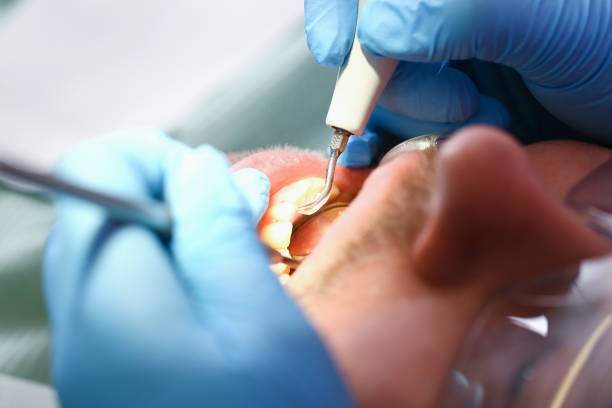 Best After-Hours Dental Trauma Care in Mitchellville, IA