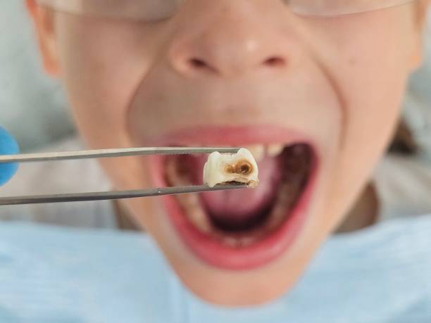 Best Same-Day Emergency Dental Services in Mitchellville, IA